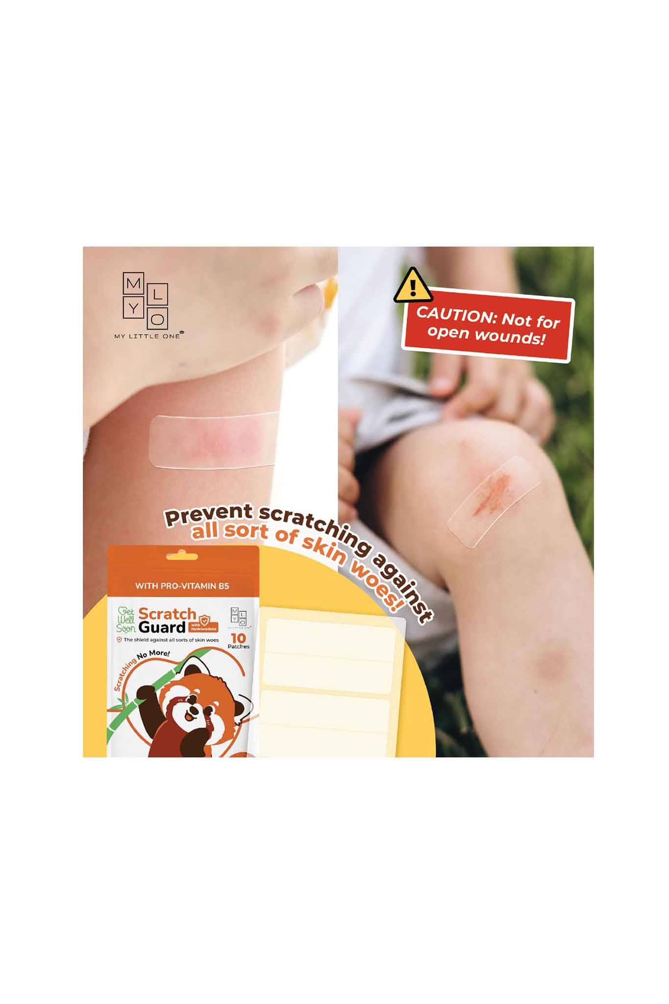 mylo scratchguard relief patch 10s