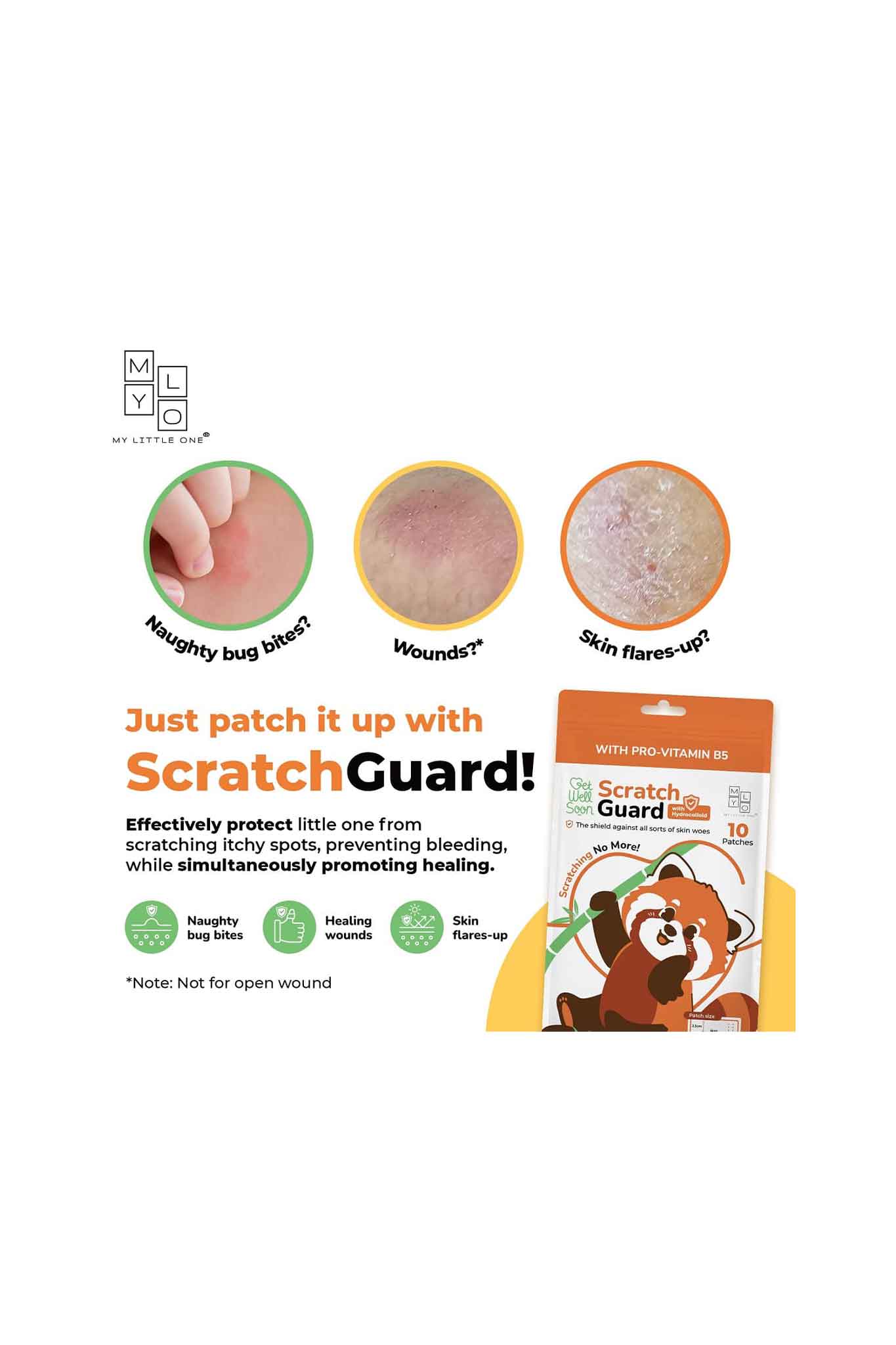 mylo scratchguard relief patch 10s